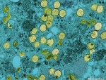 NIH启动寨卡疫苗人体临床试验：评估安全性及免疫反应能力