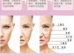 医美干货分享：变美思路、面部美学与医生测评，如何选择适合的抗衰项目
