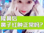 简单的捏压动作就能改变鼻型？还是这种做法潜藏着被忽视的风险？